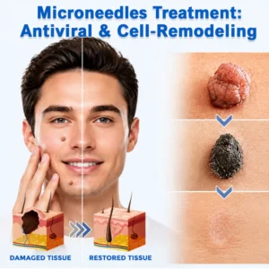 Hiskin Microneedle Clear Patches
